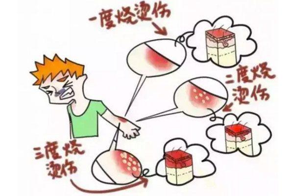 不小心被热油烫到起了水疱，正确的处理方式是