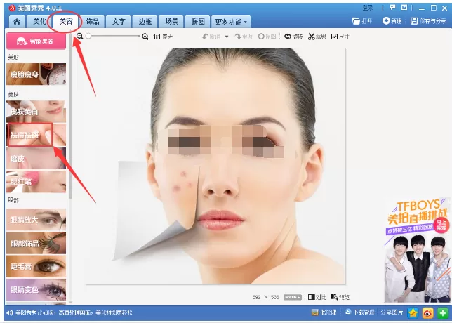 美图秀秀去除照片上痘痘疤痕的操作教程