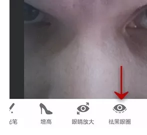 在手机美图秀秀中使用去除黑眼圈功能的详细方法