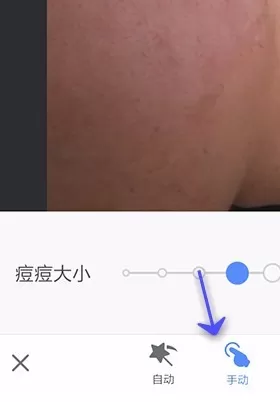 在手机美图秀秀中使用祛斑祛痘功能的详细方法