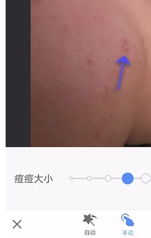 在手机美图秀秀中使用祛斑祛痘功能的详细方法