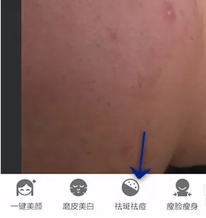 在手机美图秀秀中使用祛斑祛痘功能的详细方法