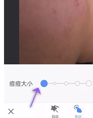 在手机美图秀秀中使用祛斑祛痘功能的详细方法