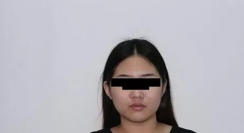 使用光影魔术手将脸部痘痘去除的详细步骤