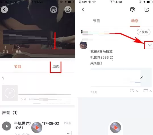 喜马拉雅FM如何删除动态?喜马拉雅FM删除动态教程