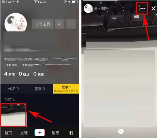 抖音短视频怎样删除故事?抖音短视频删除故事的方法