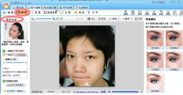 可牛影像如何打造如玉肌肤?可牛影像祛痘教程