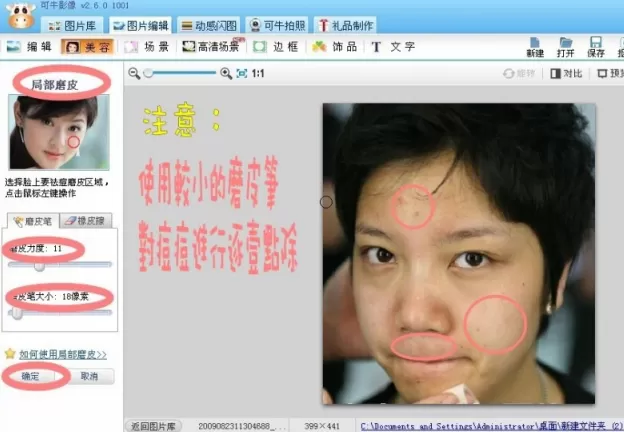 可牛影像如何打造如玉肌肤?可牛影像祛痘教程