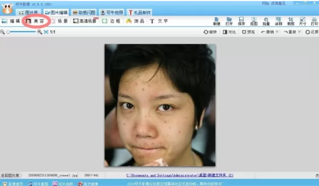 可牛影像如何打造如玉肌肤?可牛影像祛痘教程
