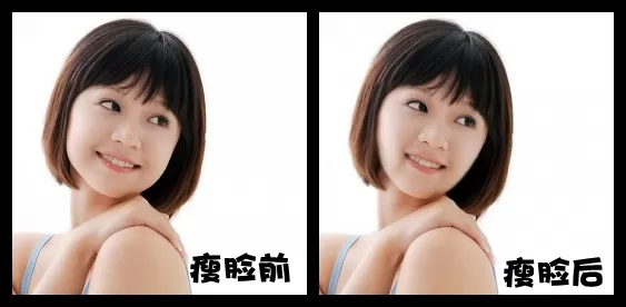 可牛影像瘦脸美容功能如何打造精致小脸?