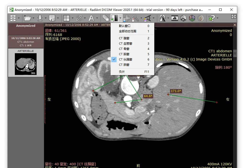 RadiAnt DICOM Viewer DICOM 医学影像看图浏览器工具软件截图